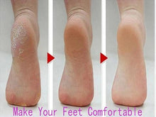 Load image into Gallery viewer, Personal Pedi (Enlèvement de la peau dure du pied)
